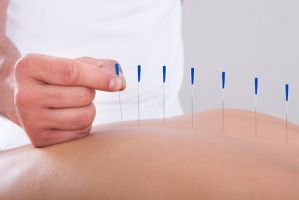 clinicas acupuntura bajar peso montevideo CLINICA MONTERO Acupuntura
